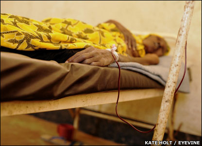 An Aids patient at the infectious disease unit of Juba Teaching Hospital 