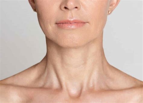 Here's When You Should Try Neck Botox | RealSelf News