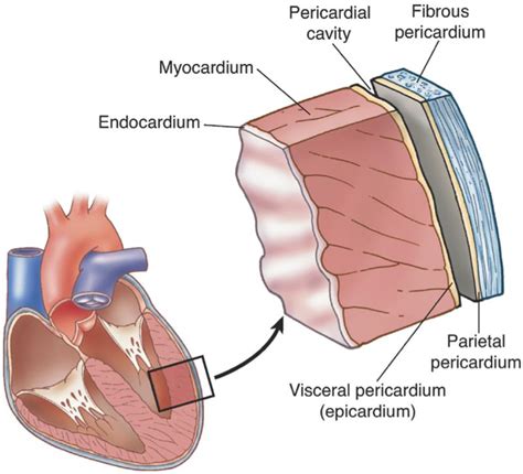 Pericarditis - Cardiovascular - Medbullets Step 2/3