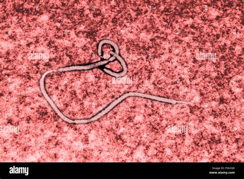 Ebola virus seen under a microscope with epidemic sign Stock Photo - Alamy