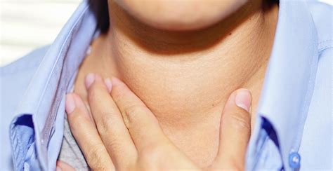 Goiter Overview: Causes & Symptoms | RxSaver