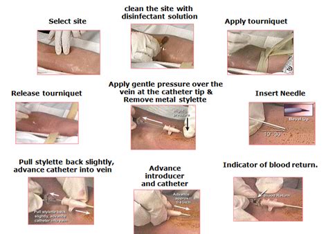 IV Therapy and Nursing Management | Nurse manager, Nursing school ...