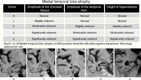 Figure 1 from Reproducibility of qualitative assessments of temporal ...