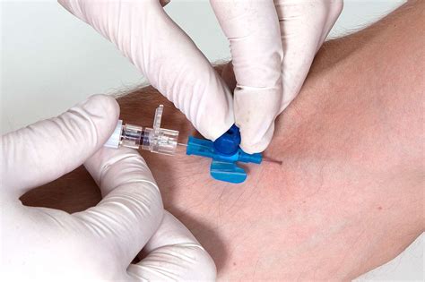 Intravenous Cannulation (IV) — Medistudents