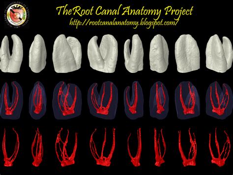 The Root Canal Anatomy Project: March 2013