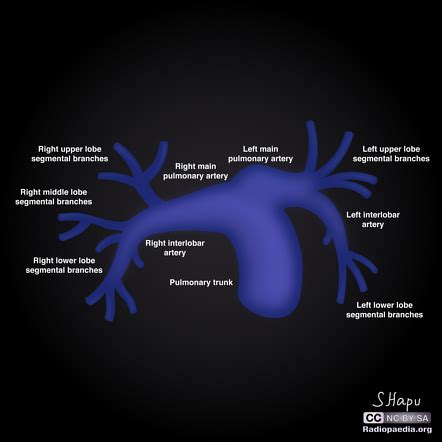 Playlist 'Pulmonary vascular anatomy and Thromboembolism' by Anish ...