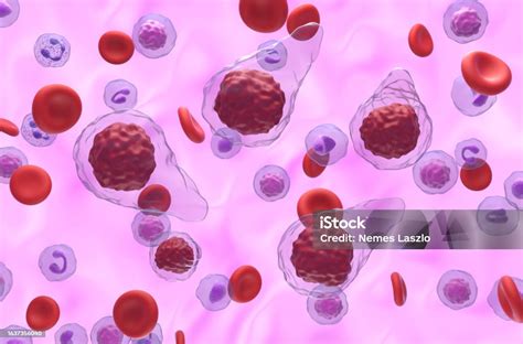 Primary Myelofibrosis Cells In Blood Flow Isometric View 3d ...