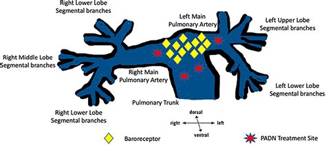 Pulmonary Artery Segmental Anatomy