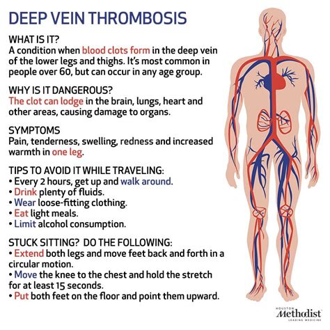 What is deep vein thrombosis? What are its symptoms? | Heart Health ...