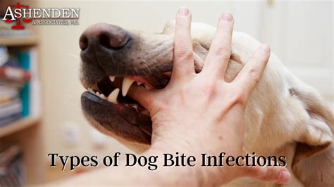 Types of Dog Bite Infections | Ashenden & Associates