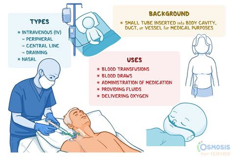 Cannula: What Is It, Different Types, and More | Osmosis