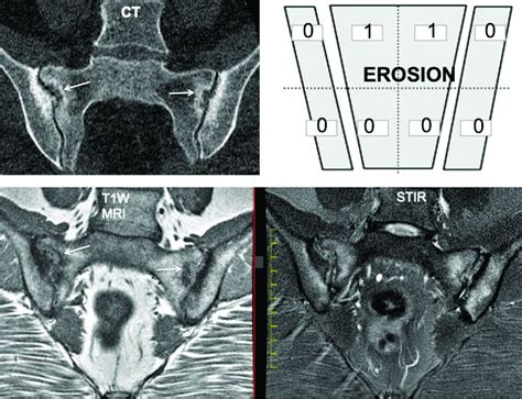 Working group proposes MRI definitions of structural lesions indicative ...