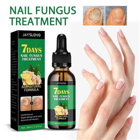 Hand Nail Fungus