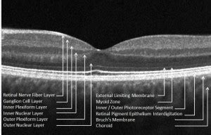 Optical Coherence Tomography Imaging Of Diseases Of The Central Nervous ...