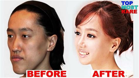 A great real life example of what plastic surgery can do - Plastic ...