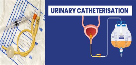 LIVIN’ WITH Urinary CATHETER | Medekom