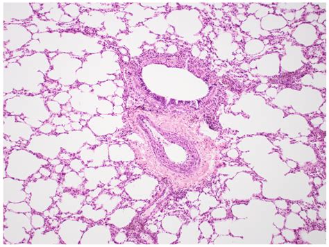 Pulmonary Artery Histology