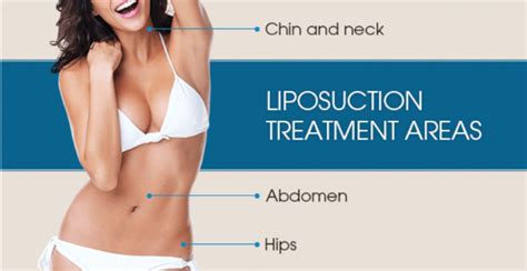 Know how to maintain liposuction results - Mixarena