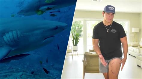 Man makes incredible recovery after suffering shark bite in Florida ...