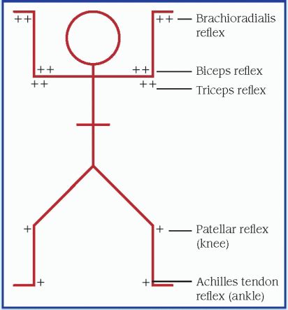 Deep Tendon Reflexes Chart