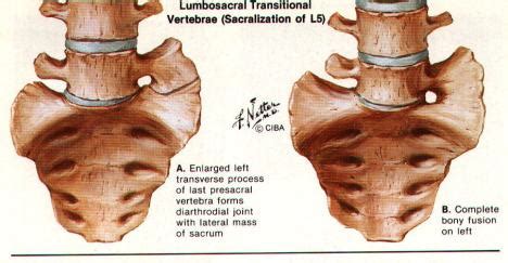 Dolor lumbar: vínculo con el dolor de espalda (¿es grave?) | lombafit