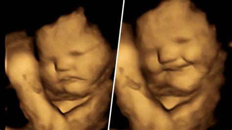 4D baby ultrasound images show fetus' possible reaction to flavors