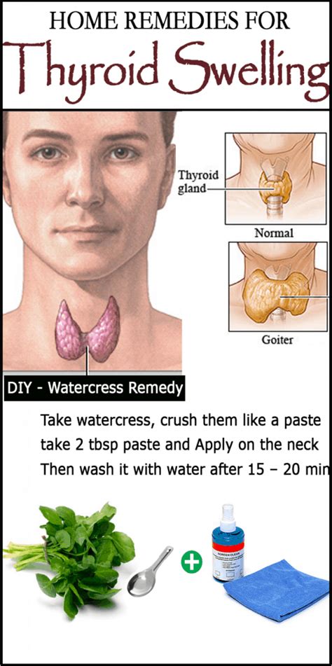 DIY Remedies For Goiter (Thyroid Swelling)