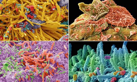 Close-up images of bacteria that live inside our mouths | Daily Mail Online