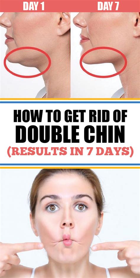 How To Get Rid Of Double Chin (Results in 7 days) - Healthy Food Remedy