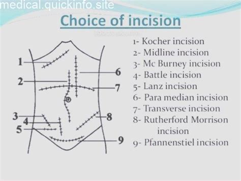 doctordconline: “Different types of Incision.. #incision #surgery # ...