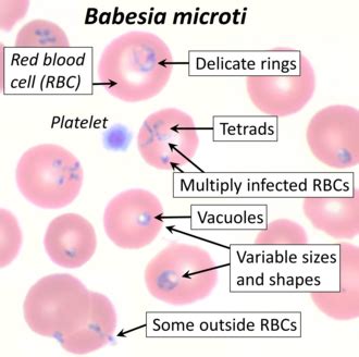 Babesia microti - Wikipedia