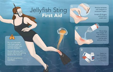 What to do if you are stung by a Jellyfish. | SCUBA DIVING SCOTLAND