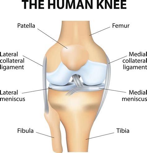 Medial Meniscus Tear