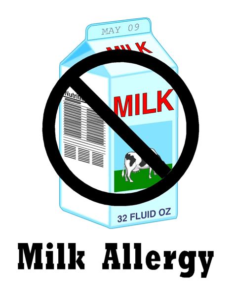 Free Posters and Signs: Milk Allergy