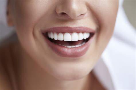 Want a Perfect Smile? 5 Things To Know Before Getting Veneers