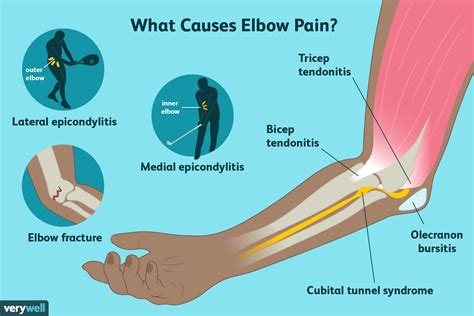 Elbow Pain: Causes and When It's Serious