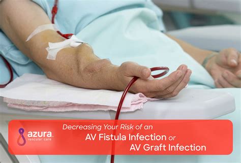 Decrease Risk of AV Fistula, AV Graft Infection