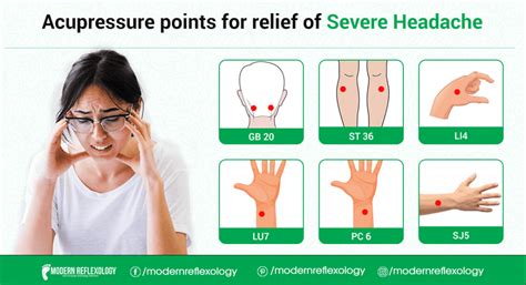 Acupressure Points for Relief Severe Headache - Modern Reflexology