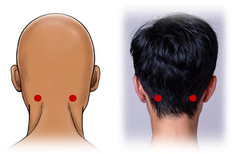 Acupressure for Neck Pain | My Doctor Online