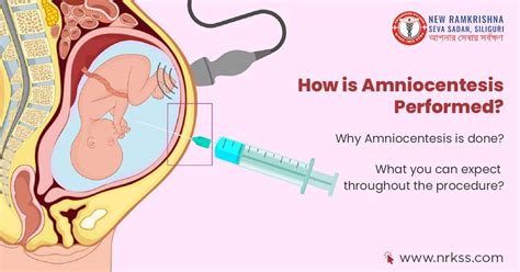 How is Amniocentesis Performed?