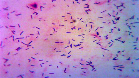 Lactobacillus Casei Gram Stain