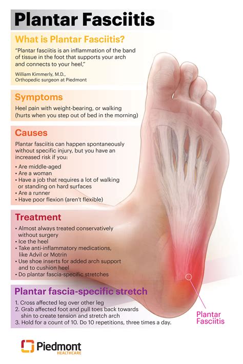 Plantar Fasciitis Symptoms and Treatments | Piedmont Healthcare