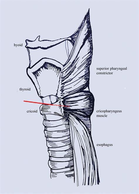 Cricopharyngeus