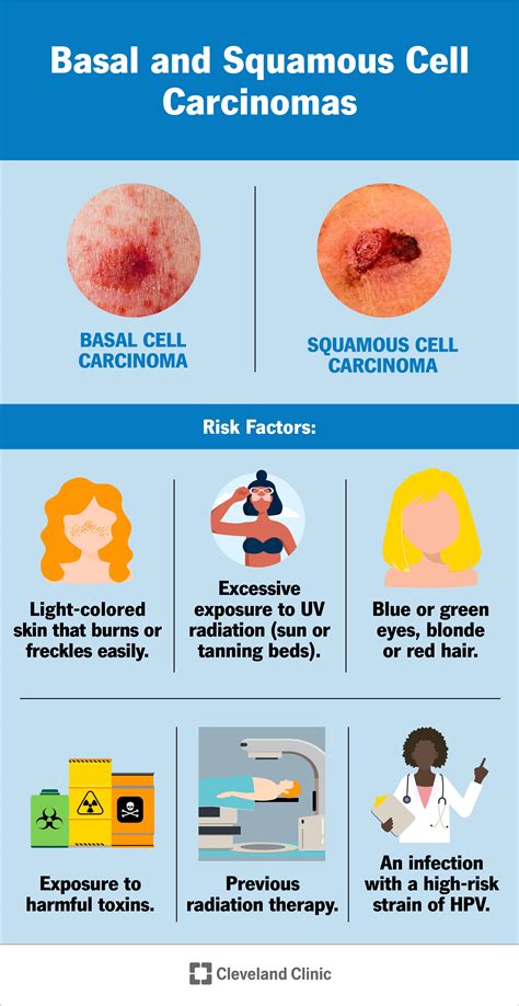 Carcinoma: Types, Treatment & What it Is