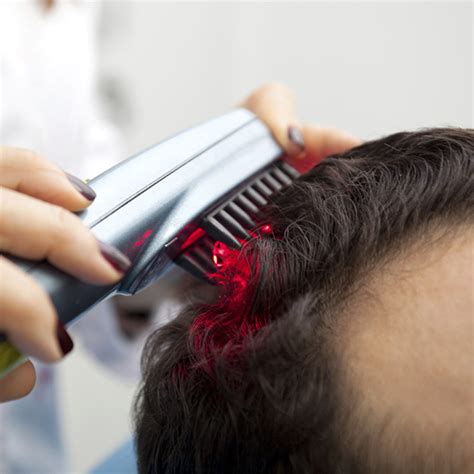 Does Laser Therapy for Hair Growth Work?