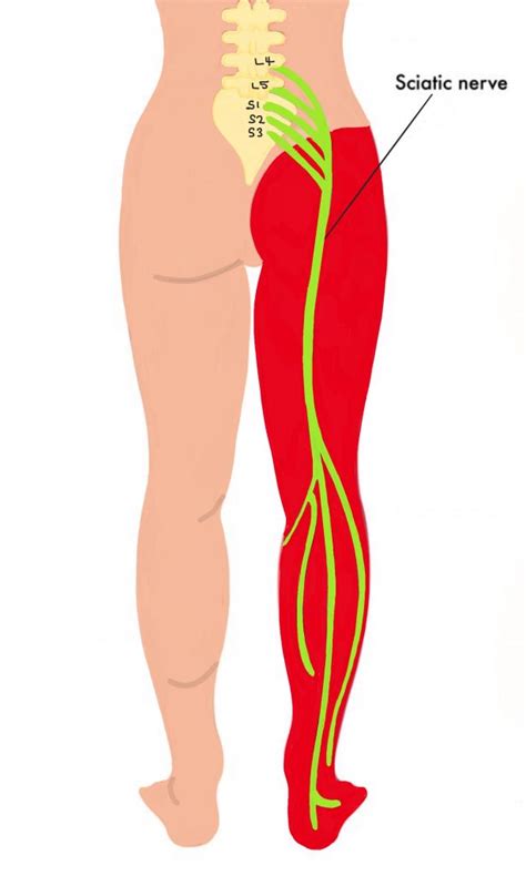 Sciatic nerve dermatome - The Iveson Clinic for Physiotherapy and ...