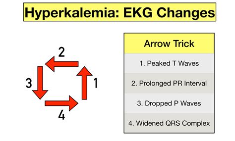 Hyperkalemia ECG Changes, Findings, and Progression of Effects on the ...