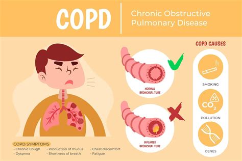 What is Chronic Obstructive Pulmonary Disease (COPD)