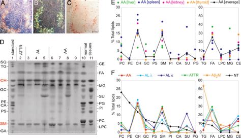 Tissue-deposited amyloid fibrils are associated with lipids. (A-C ...