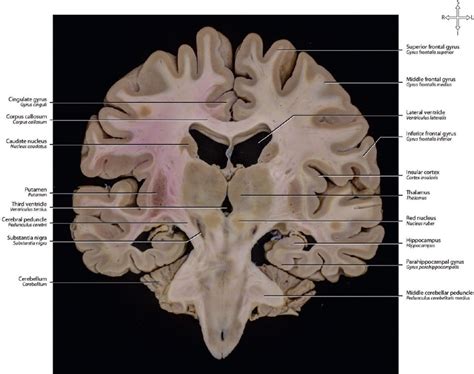 27 Brain Sections | Neupsy Key